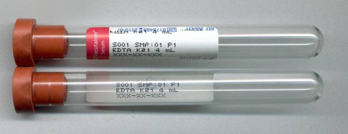 Labeling exercise 8 1 patient id and blood specimen label